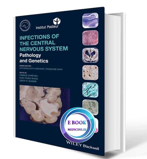 دانلود کتابInfections of the Central Nervous System: Pathology and Genetics (International Society of Neuropathology Series)2020 (ORIGINAL PDF)